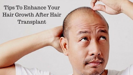 TIPS To Enhance Your Hair Growth After Hair Transplant - TRICITY INSTITUTE  OF PLASTIC SURGERY